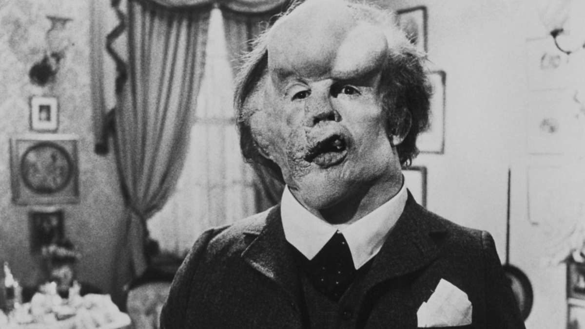 The Elephant Man (1980) review